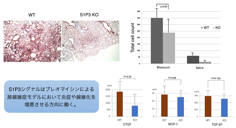 Sphingosine-1-phosphate(S1P)の炎症および骨代謝における役割の解析
